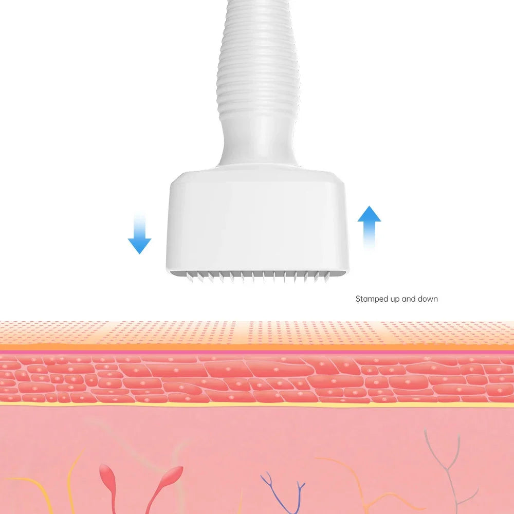 White 140Pins Derma Stamp Adjustable Needle Length 0.25mm Microneedle Real Needle Skin Care Beard Growth Scalp Hair Re-Growth
