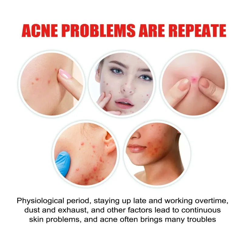 400pcs Star Acne Patches Invisible Pimple Cover for Face Oil Control Spot Treatment Cute Sticker for Covering Zits and Blemishes