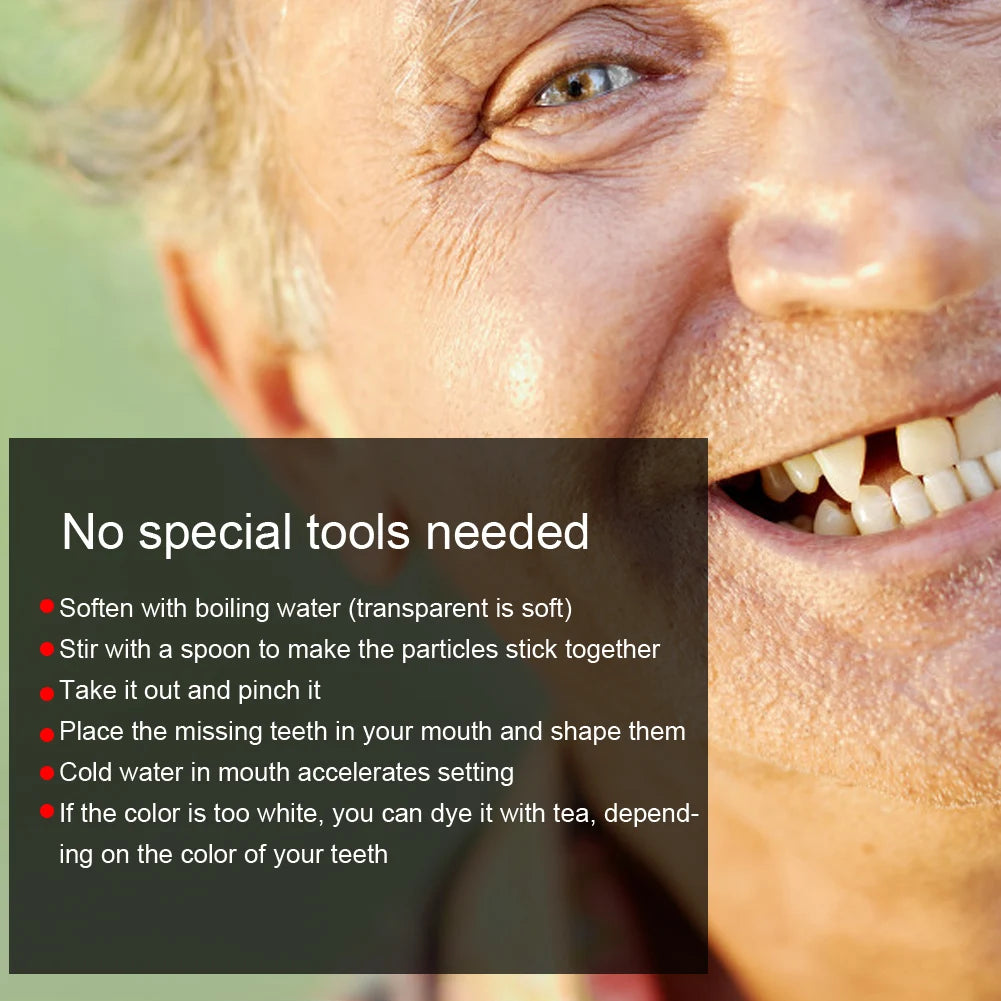Tooth Repair Bead Broken Teeth Repair Temporary Tooth Repair Beads for Missing Broken Teeth Dental Tooth Filling Material