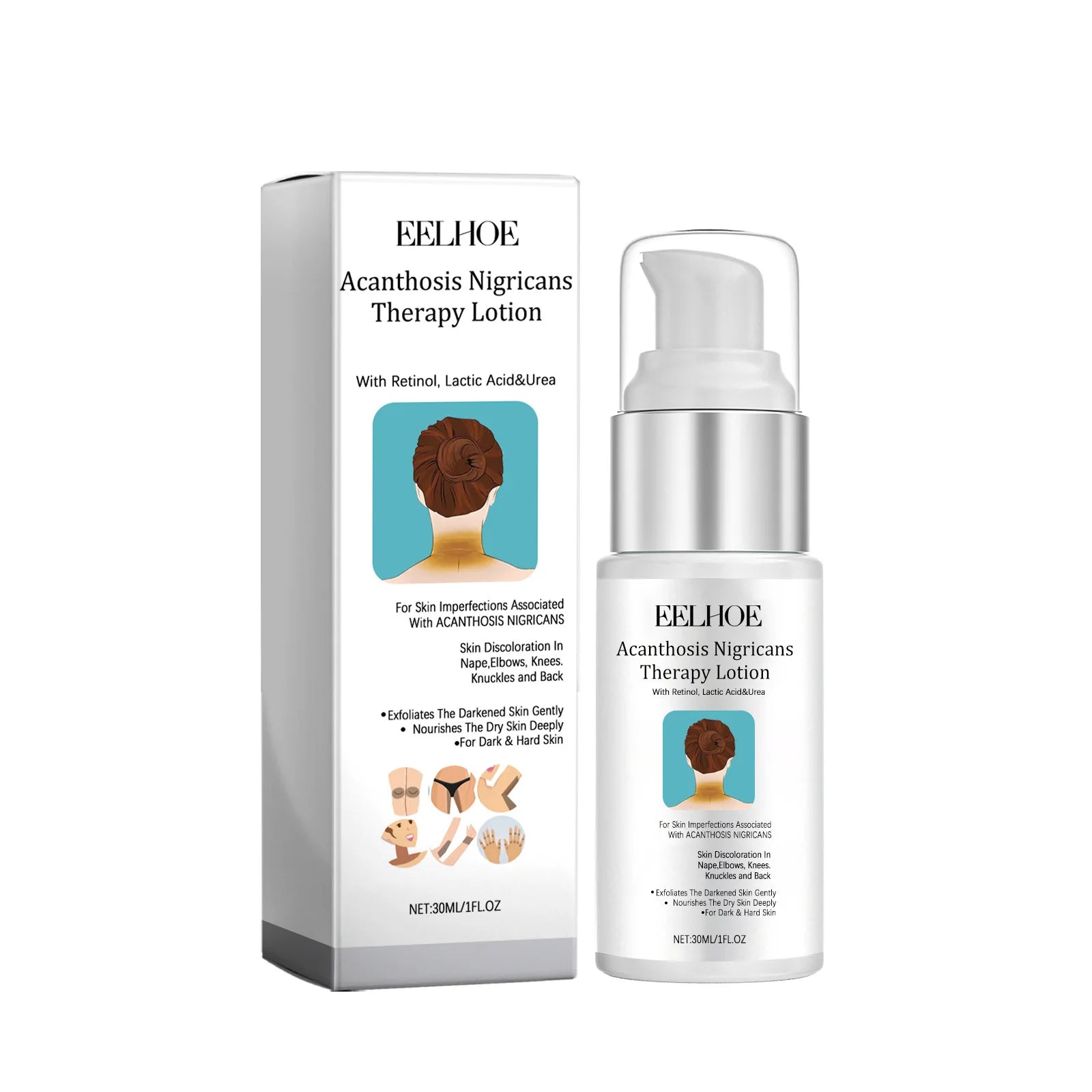 EELHOE Acanthosis Nigricans Therapy Cream Neck Arm Knee Joint Underarm Whitening Nourish Body Care Set Acantosis Nigricans Cream