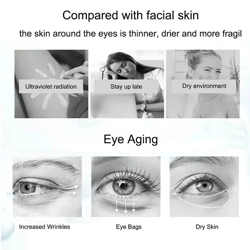 Nicotinamide Eyes Cream Dark Circles Fading Eye Bags Eye Hyaluronic Acid Moisturizing Serum Against Puffiness Eye Care Gel