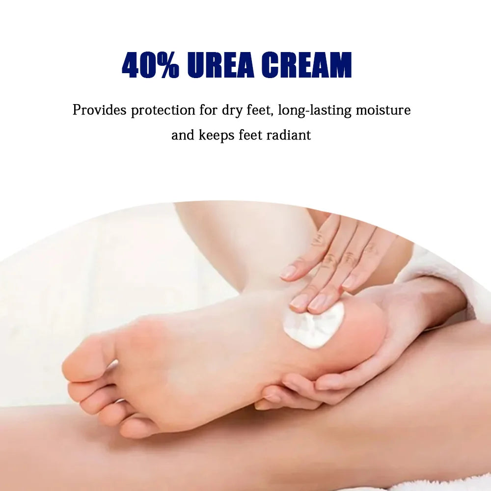 YOUNGCOME 40% urea cream+2% salicylic acid hand and foot deep moisturizing cream, protect and moisturize your skin all day long