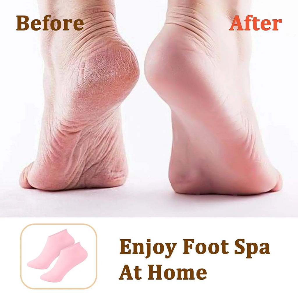 2 Pairs Of Moisturizing Silicone Foot Socks - Specially Designed For Cracked Feet, Contains Massage And Moisturizing Gel