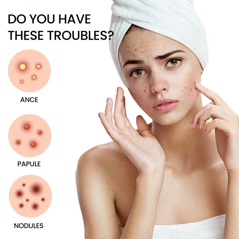 400pcs Star Acne Patches Invisible Pimple Cover for Face Oil Control Spot Treatment Cute Sticker for Covering Zits and Blemishes