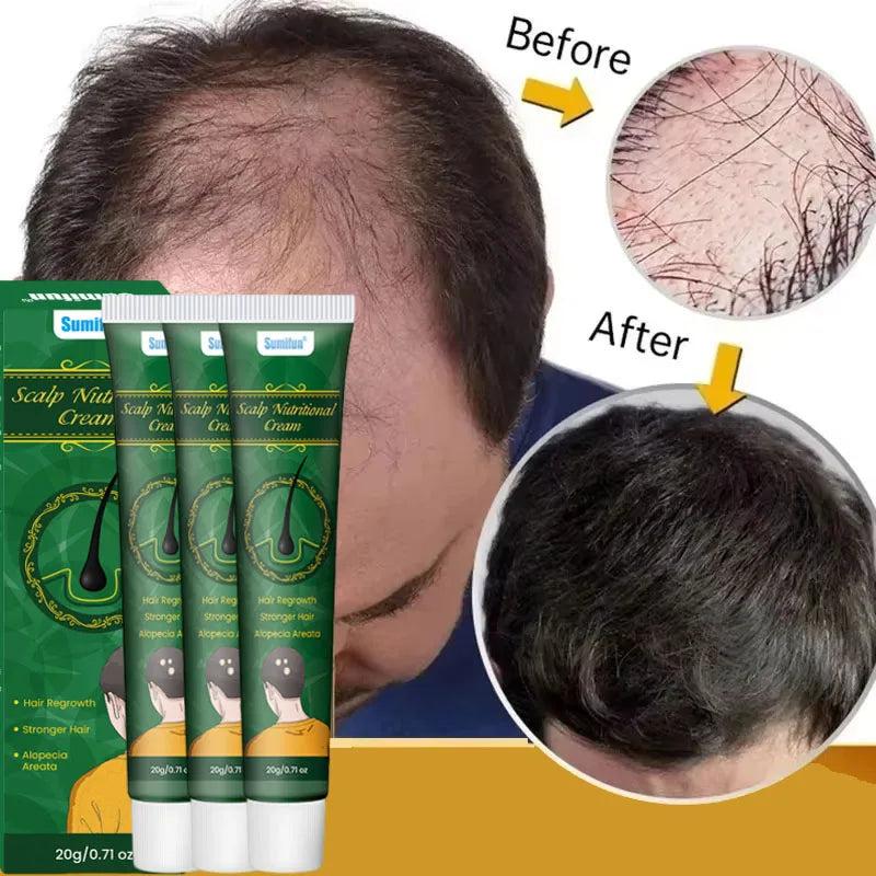 8 Days Fast Hair Growth Cream Anti Hair Loss Prevent Baldness Scalp Treatment Repair Roots Beauty Health Hair Care For Men Women