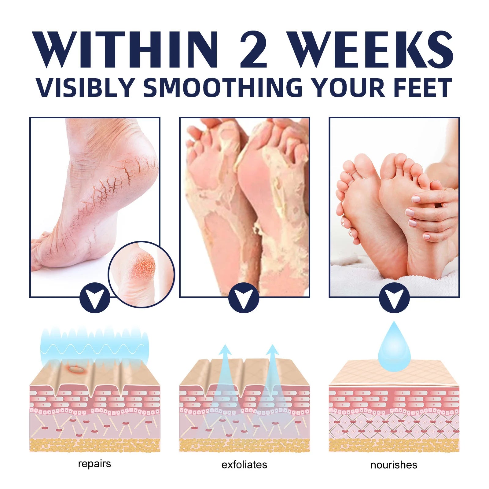 Anti Crack Cream Heel Chapping Repair Dead Skin Removal Anti-Drying Hand Treatment Nourishing Foot Dryness Cracked Repair Cream