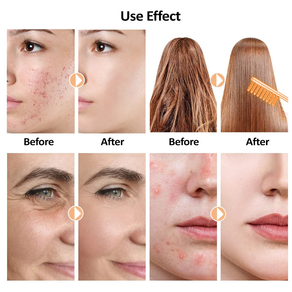 Handheld Electric Skin Therapy Wand 4-in-1 Facial Beauty Tool for Acne Treatment Massage Skin Tightening Wrinkle Reduction