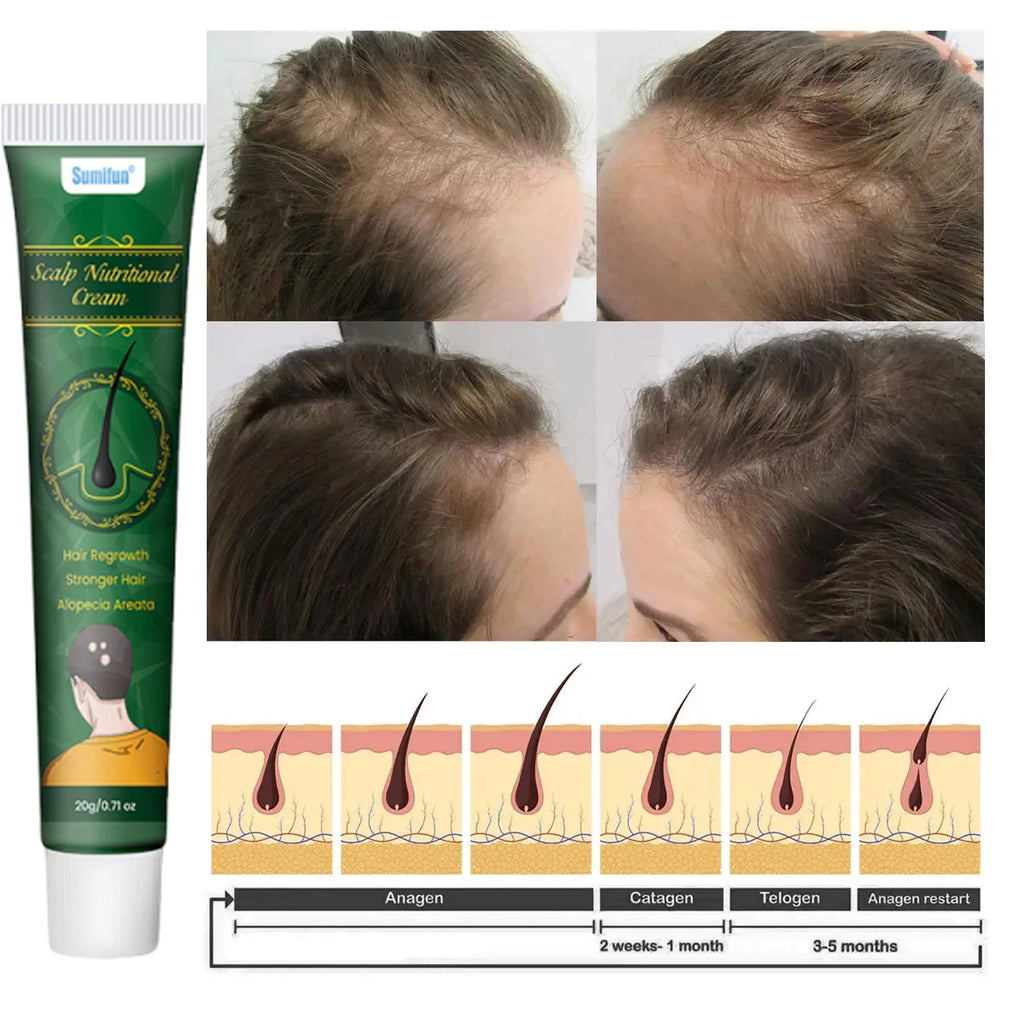 8 Days Fast Hair Growth Cream Anti Hair Loss Prevent Baldness Scalp Treatment Repair Roots Beauty Health Hair Care For Men Women