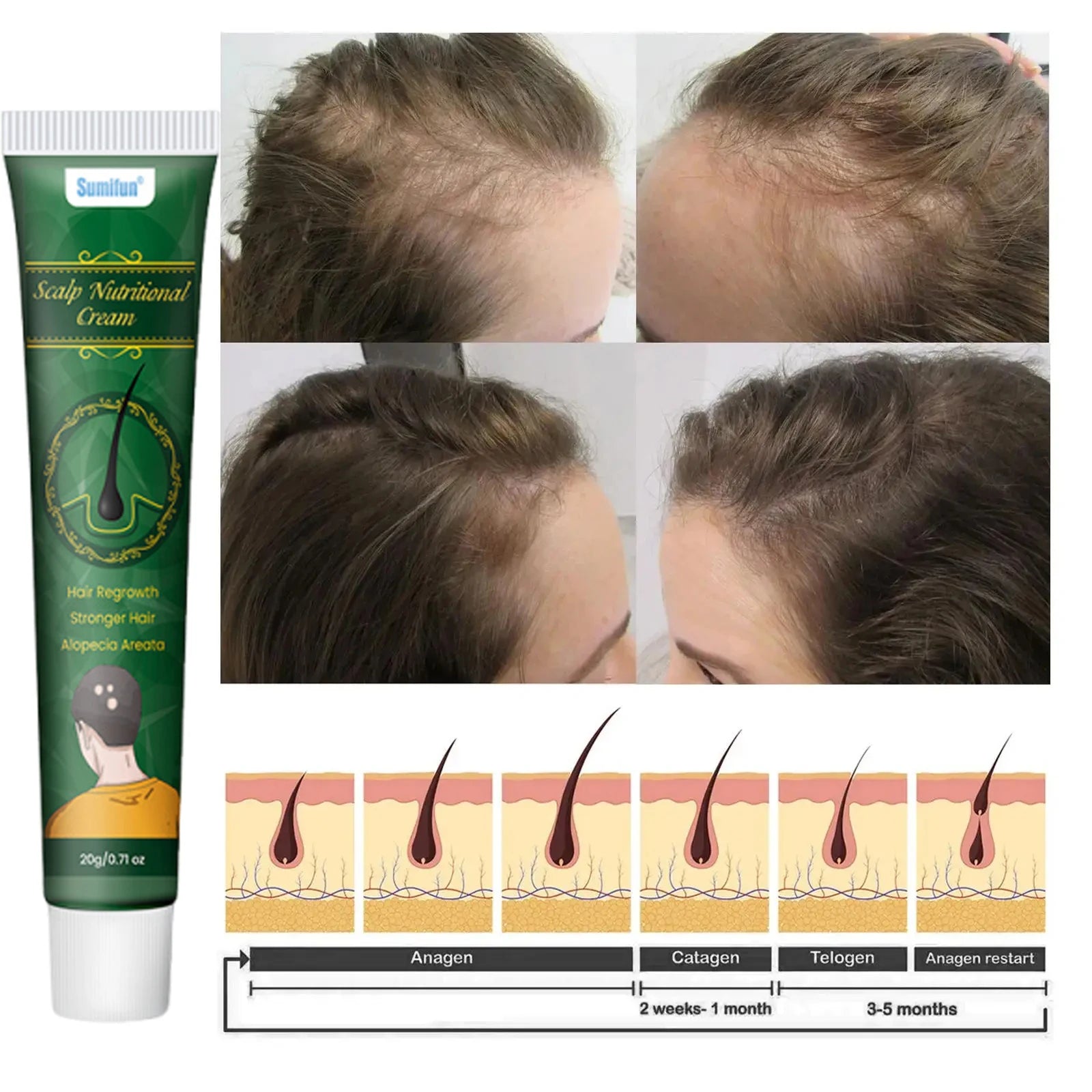 8 Days Fast Hair Growth Cream Anti Hair Loss Prevent Baldness Scalp Treatment Repair Roots Beauty Health Hair Care For Men Women