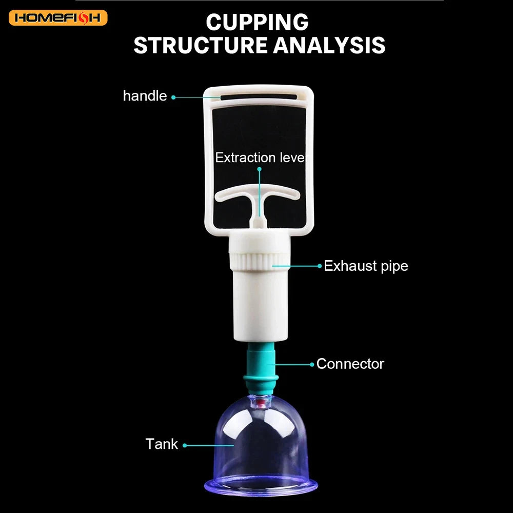 6-Piece Suction Cup Set with Hand Pump – Vacuum Cupping Tool for Back & Body Use