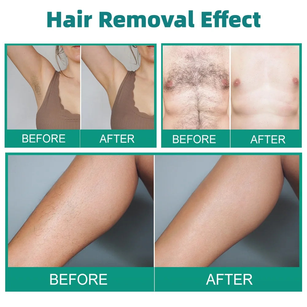 2 in 1 Electrolysis Hair Removal Machine Painless Permanent Hair Remove Machine for Women Men Bikini Body Home Salon Use