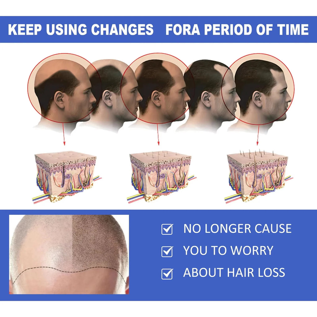 Ginger Hair Growth Spray Anti Hair Fall Hair Loss Treatment Hair Growth Essence Oil for Men Women Hair Treatment
