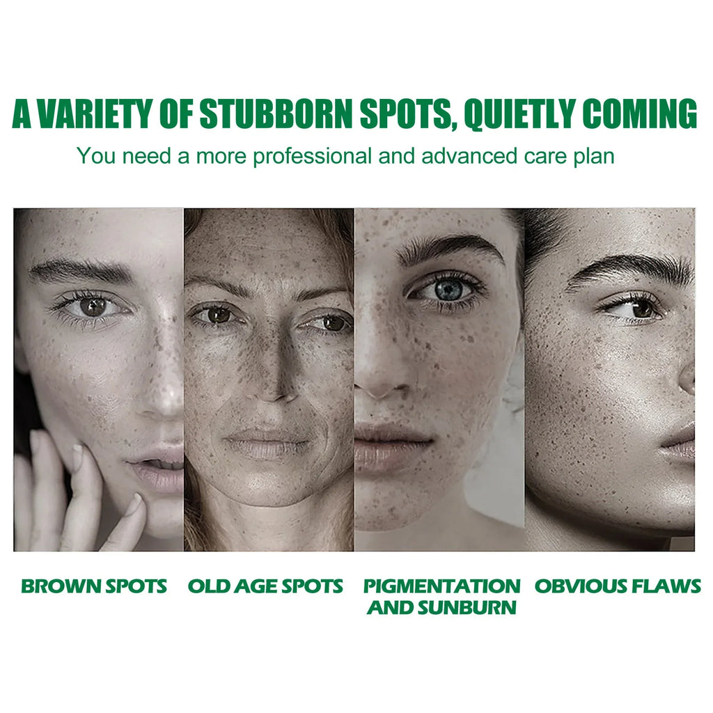 Whitening Freckle Serum Fade Pigmentation Moisturizing Brightening Improve Dull Anti Aging Remove Dark Spots Face Care Essence