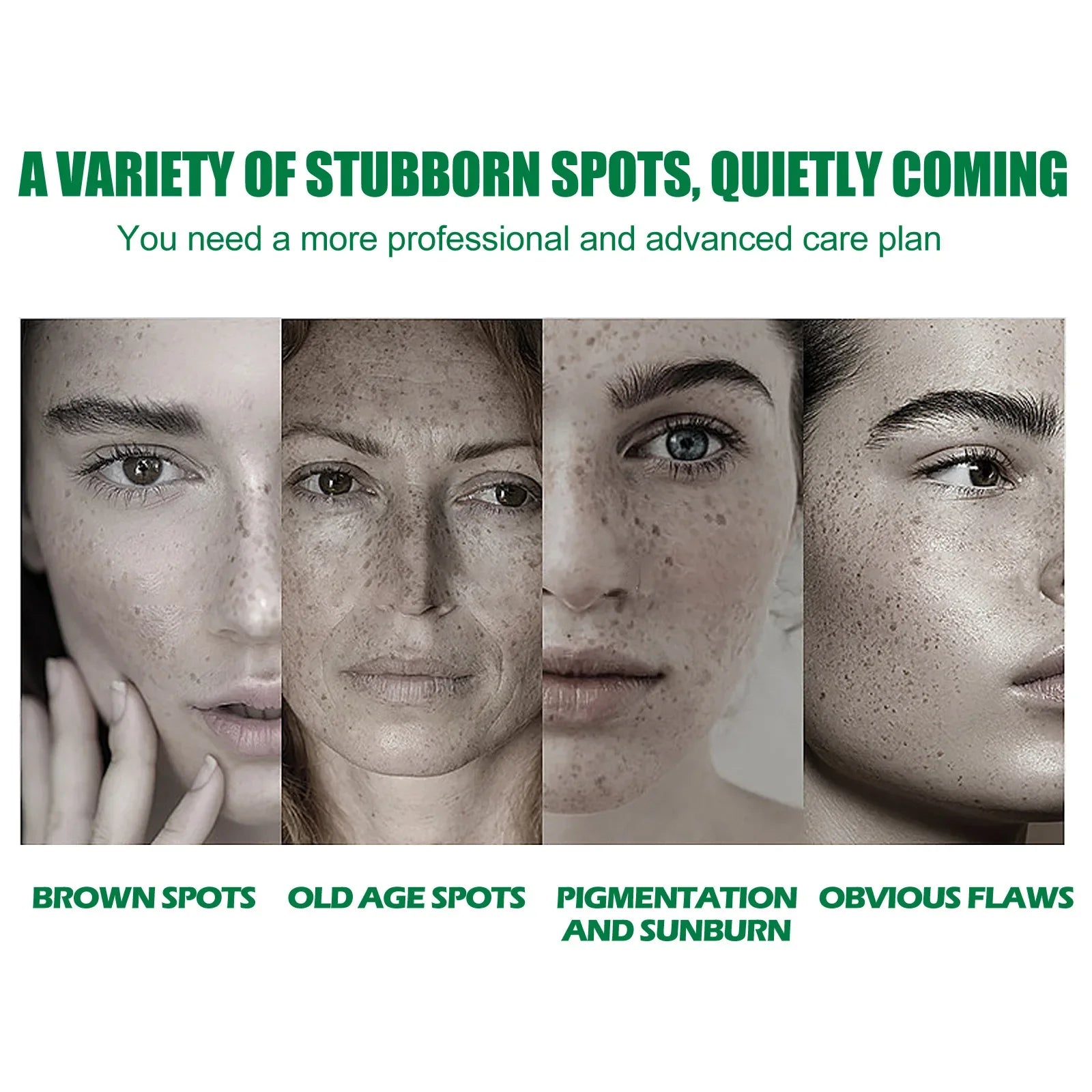 Whitening Freckle Serum Fade Pigmentation Moisturizing Brightening Improve Dull Anti Aging Remove Dark Spots Face Care Essence