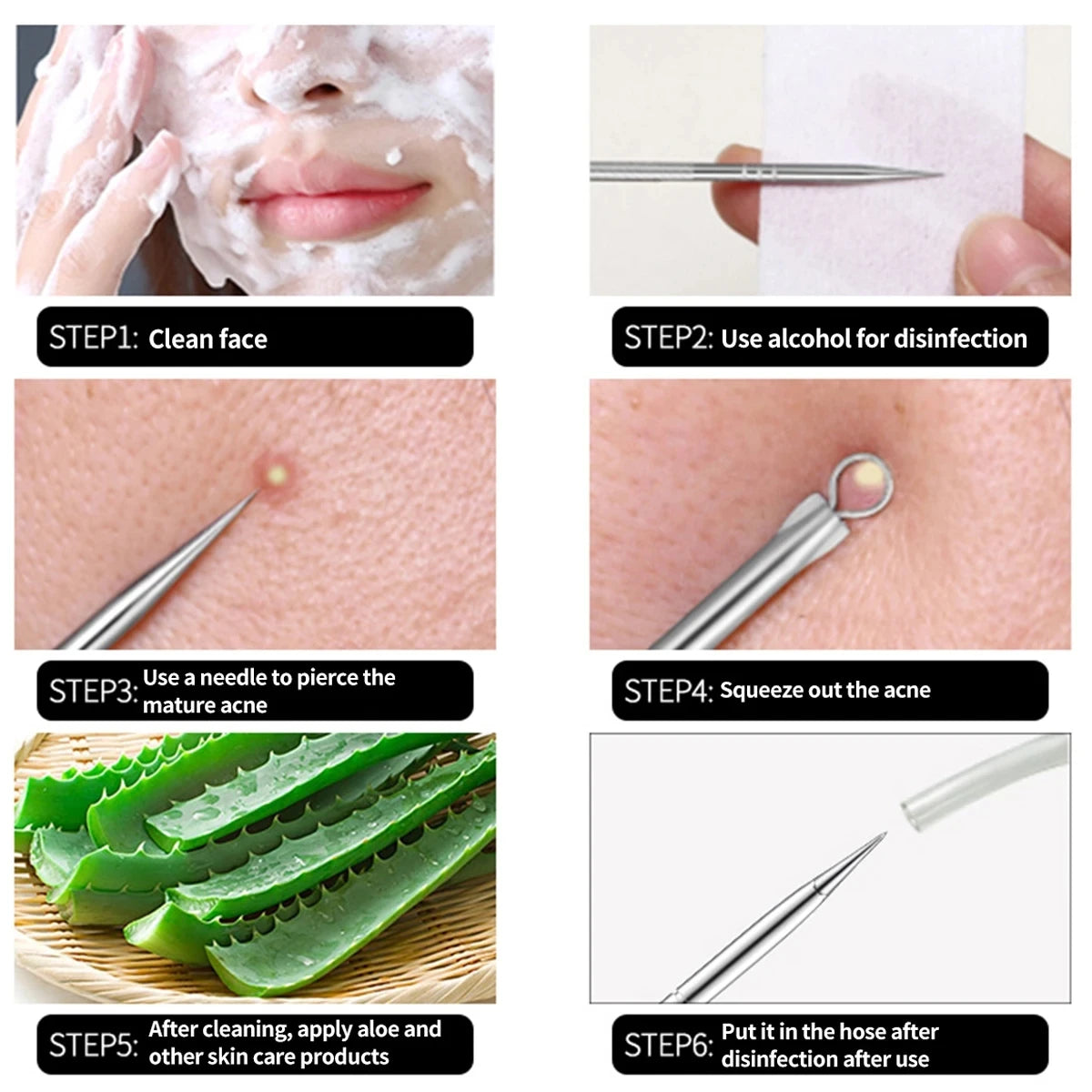 4PCS Acne Blackhead Comedone Black Spot Pimple Blemish Remover Skin Care Needle Facial Pore Cleanser Hook Beauty Cleaning Tool