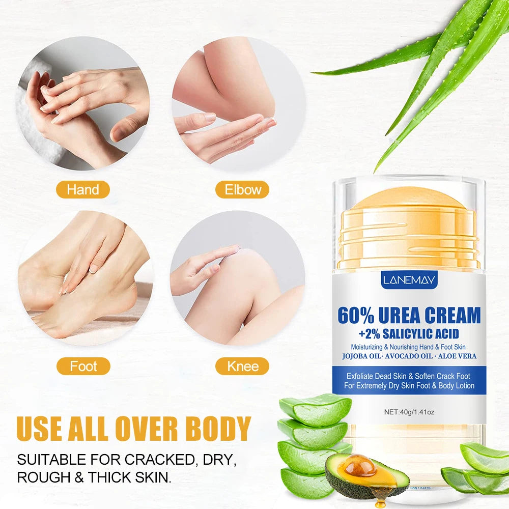 80g Ultra-hydrating 60% Urea Foot Cream For Softening Dry Cracked Feet Gentle Exfoliation Peeling Foot Care Moisturizing Cream