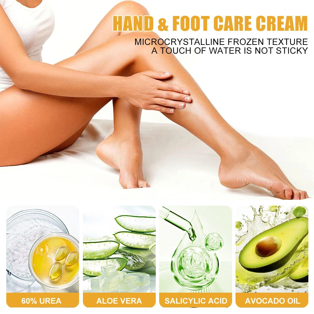 80g Ultra-hydrating 60% Urea Foot Cream For Softening Dry Cracked Feet Gentle Exfoliation Peeling Foot Care Moisturizing Cream
