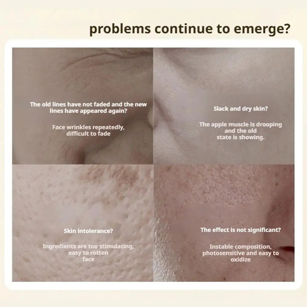 QINGLING Anti Wrinkle Face Cream Polypeptide Firms Skin Texture & Lightens Fine Lines Rejuvenating Repair For Morning Night